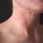 skin specialist near me