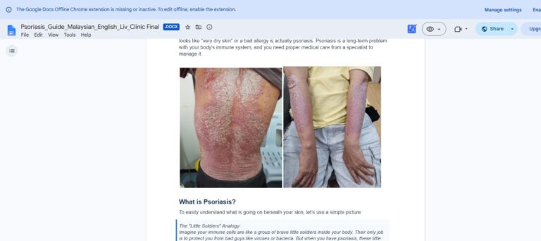 psoriasis-patches-back-arm